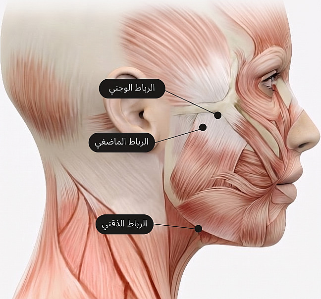 رسم تشريحي يوضح عضلات جانب الوجه وأماكن الأربطة الداعمة للوجنة والعضلة الماضغة والفك المرتبطة بجراحة شد الوجه عبر طبقة SMAS