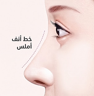 رسم جانبي لامرأة يوضح خط أنف مستقيماً وأملس بخط منقط بعد جراحة الأنف المعقوف مع عبارة خط أنف ناعم