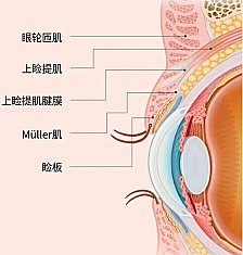 用于男性眼部整形的眼睑解剖图中，显示眼轮匝肌、提上睑肌、上睑提肌腱膜、米勒肌与睑板位置的剖面图