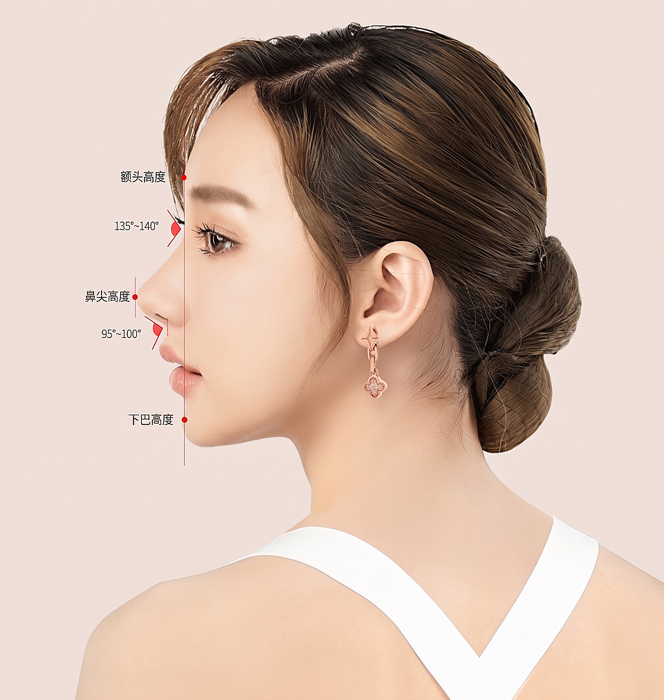女性侧脸标有额头高度、鼻梁高度、下巴高度及角度基准线的塌鼻鼻部整形侧面比例分析图