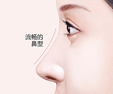 通过驼峰鼻整形呈现流畅鼻梁线条的女性侧面及光滑鼻线条文字