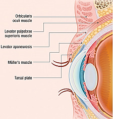 Cross-sectional eyelid anatomy diagram for men's eye surgery showing the locations of the orbicularis oculi, levator palpebrae superioris, levator aponeurosis, Müller's muscle, and tarsal plate