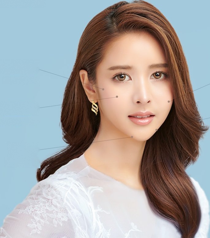 Diagram indicating Thread Lift target areas such as facial contours, front and side cheekbones, and double chin on a woman's face