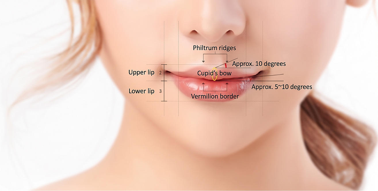 Ideal lip proportions diagram on a close-up of a female lower face, showing the 2:3 ratio of the upper to lower lip, lip peaks, Cupid's bow, and lip mucosal angle