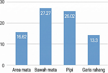 Grafik batang yang menunjukkan angka per area setelah tindakan Rejuran, dengan nilai terukur sekitar mata 16,62, bawah mata 27,27, pipi 26,02, dan garis rahang 13,3