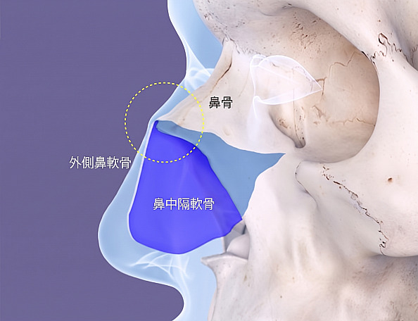 わし鼻整形の鼻の解剖学構造図解で鼻骨、鼻翼軟骨、鼻中隔軟骨の部位が示されたグラフィック