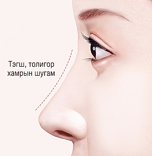Овгор хамар засах мэс заслын дараах шулуун, толигор хамрын нурууны шугамыг тасархай зураасаар харуулсан эмэгтэйн хажуу дүр төрхийн зураглал ба толигор хамрын шугам бичиг