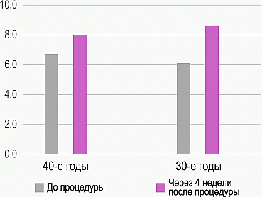 Гистограмма сравнения показателей до процедуры Rejuran и через 4 недели после нее