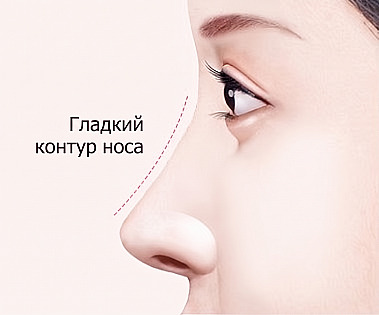 Профиль женщины с гладкой спинкой носа после коррекции горбинки на носу и текст Гладкая линия носа