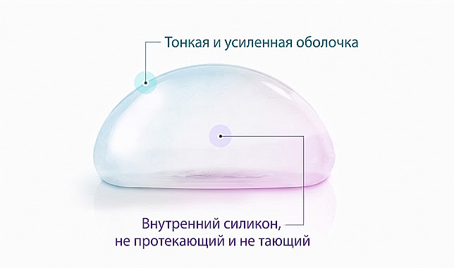 Схема, поясняющая структуру импланта для увеличения груди с тонкой, но прочной оболочкой и наполнителем из силиконового геля, сохраняющего форму