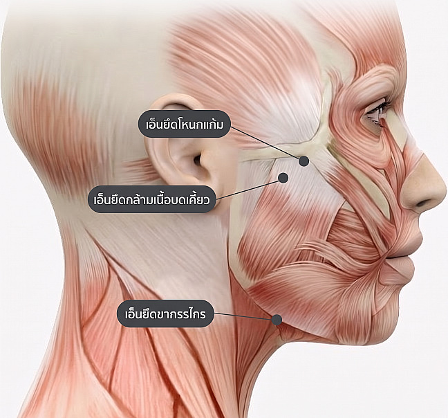 ภาพกายวิภาคแสดงตำแหน่งของกล้ามเนื้อใบหน้าด้านข้าง เส้นยึดโหนกแก้ม เส้นยึดกล้ามเนื้อบดเคี้ยว และเส้นยึดยึดขากรรไกร ที่เกี่ยวข้องกับศัลยกรรมดึงหน้าชั้น SMAS