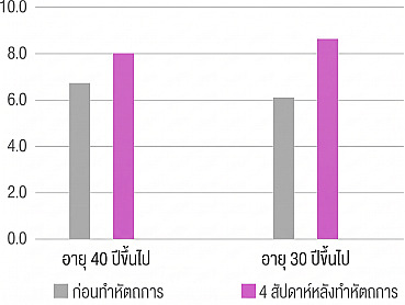 แผนภาพกราฟแท่งเปรียบเทียบการเปลี่ยนแปลงของค่าตัวเลขก่อนและหลังทำ Rejuran 4 สัปดาห์