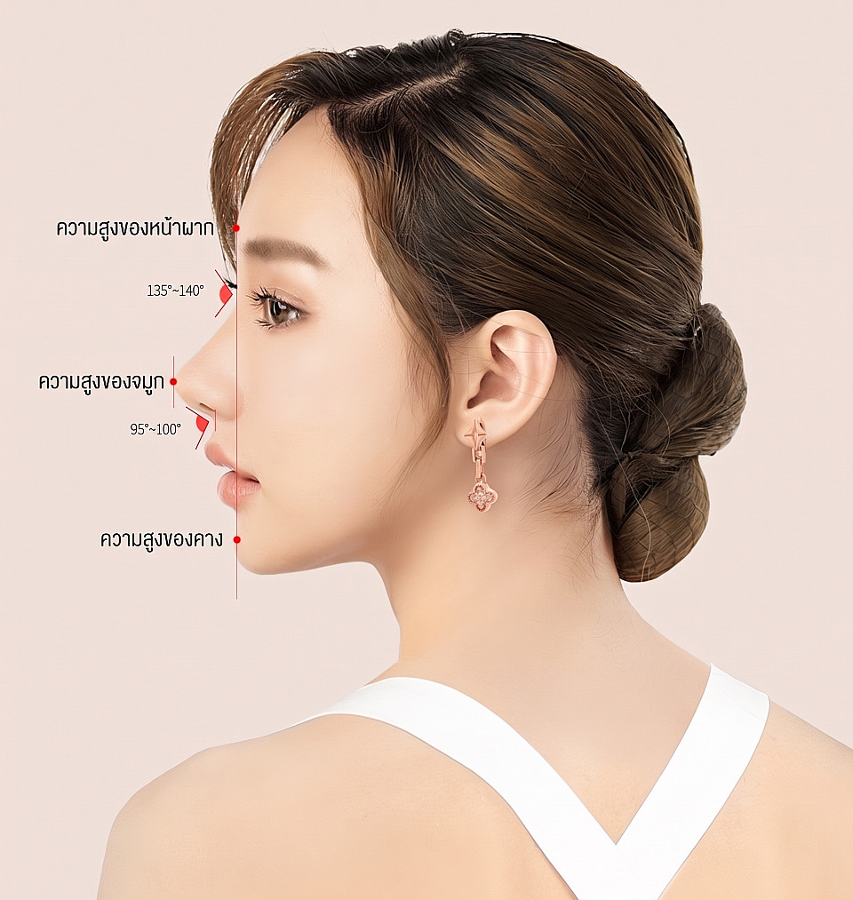 ภาพแผนภาพวิเคราะห์สัดส่วนด้านข้างสำหรับศัลยกรรมจมูกแบน แสดงเส้นอ้างอิงความสูงของหน้าผาก สันจมูก และคางด้านหน้าพร้อมมุมต่างๆ บนใบหน้าด้านข้างของผู้หญิง