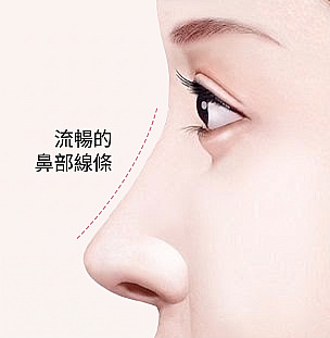 駝峰鼻整形後以虛線標示筆直流暢鼻樑線條的女性側臉插圖與光滑鼻線字樣