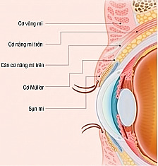 Mặt cắt giải phẫu mí mắt cho phẫu thuật mắt nam giới thể hiện vị trí cơ vòng mi, cơ nâng mi, cân cơ nâng mi trên, cơ Müller và sụn mi