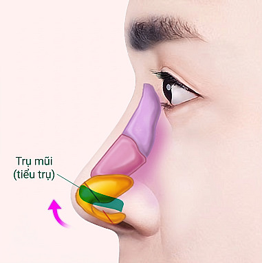 Sơ đồ cấu trúc bên trong góc nghiêng thể hiện nguyên lý nâng cao đầu mũi bằng cách cấy trụ nâng vào vách ngăn trụ mũi trong phẫu thuật mũi nam giới