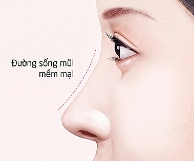 Góc nghiêng của người phụ nữ sở hữu đường sống mũi mượt mà nhờ phẫu thuật mũi gồ cùng dòng chữ đường nét mũi mượt mà
