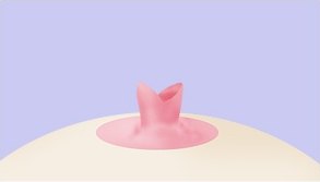 Sơ đồ 3D các bước phẫu thuật núm vú thụt phương pháp không bảo tồn ống dẫn sữa với đầu núm vú mở tách đôi trên nền tím nhạt