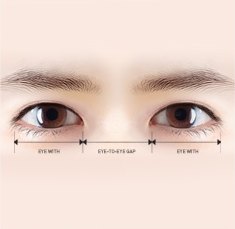 남자 눈성형을 위한 정면 눈매 분석 도해로 좌우 눈의 가로 길이와 미간 간격을 화살표와 수치선으로 표기