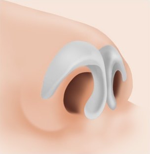 에이펙스 코끝 성형 수술 전 코끝의 콧날개 연골 구조를 나타낸 3D 일러스트