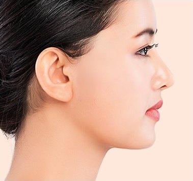 なめらかなフェイスラインと弾力のある肌を見せる女性の右横顔とミニ切開リフト施術例