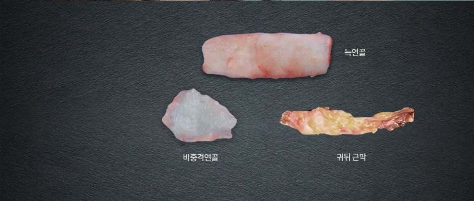 무보형물 코성형에 사용되는 자가조직인 늑연골, 비중격연골, 귀뒤 근막이 검은 배경 위에 놓인 모습