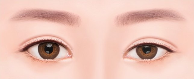 좌우 쌍꺼풀 라인의 높이와 모양이 비대칭인 눈재수술 적용 대상 일러스트
