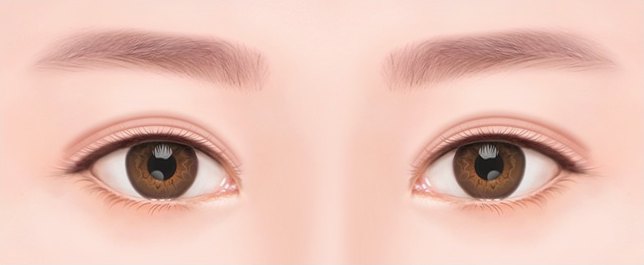 눈재수술 케이스 설명을 위한 겹쌍꺼풀과 눈두덩 꺼짐이 있는 눈 일러스트