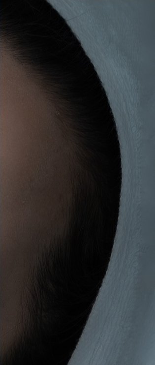 윤곽주사 시술 부위 측면 전후 비교 중 머리 윤곽과 턱선 주변을 보여주는 근접 모습