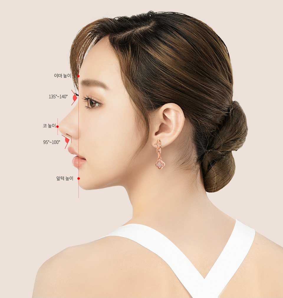 여성의 옆얼굴에 이마 높이, 코 높이, 앞턱 높이와 각도 기준선을 표시한 낮은코 코성형 측면 비율 분석 도해