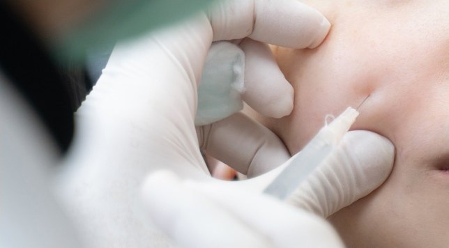 Tim medis bersarung tangan medis memegang lembut kulit pipi pasien dan menyuntikkan skin botox dengan jarum halus