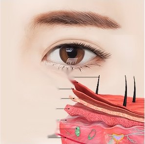 하안검 수술 설명을 위해 눈 밑 피부의 표피, 진피 등 다층 구조를 단면으로 나타낸 해부학적 일러스트 다이어그램