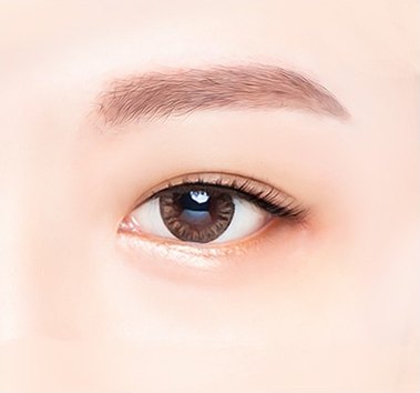 하안검 수술 후 눈 밑 주름과 처짐 없이 매끄럽게 정돈된 한쪽 눈 클로즈업 모습