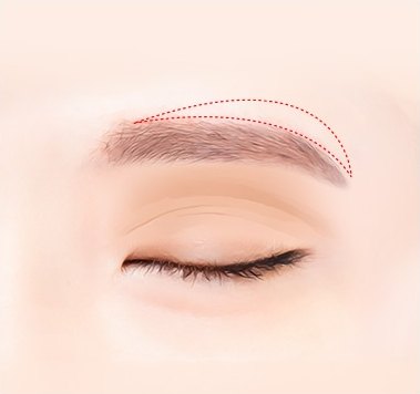 눈썹거상술을 위해 눈썹 윗부분 절개 예정 범위를 붉은 점선으로 디자인한 눈 일러스트