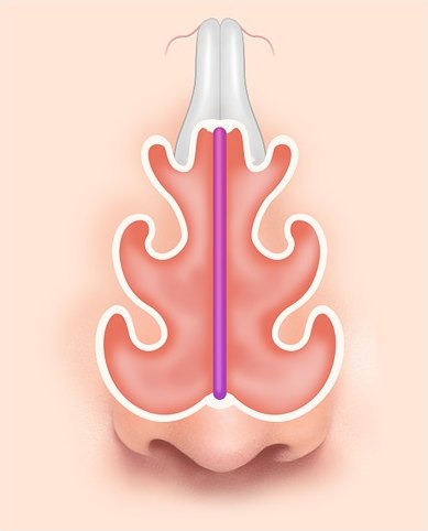 에이펙스성형외과 휜코 성형 도해 중 비중격이 중앙에 곧게 뻗어 있는 정상 코 내부 구조 단면