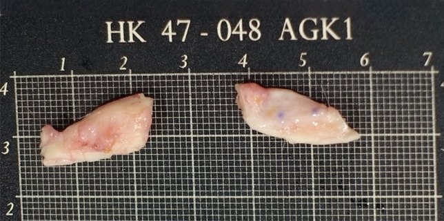 귀족수술용 검은색 눈금 계측판 위에 놓인 두 조각의 절제된 자가조직 표본