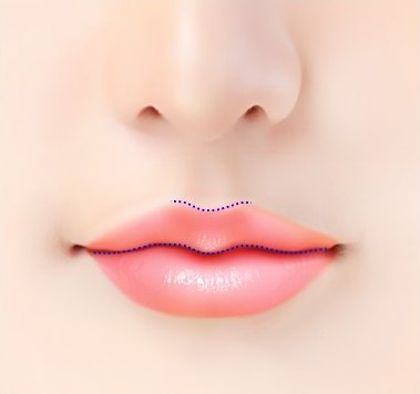 입술성형 가이드로 윗입술의 큐피드 활 모양과 M자 라인을 점선으로 표시한 입술 클로즈업 도해
