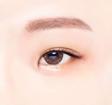 트임성형 수술 전 눈 앞머리 몽고주름 상태를 보여주는 오른쪽 눈 일러스트