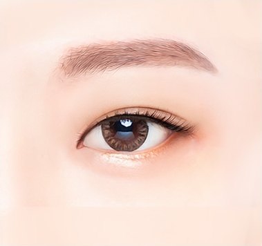갈색 컬러 렌즈와 또렷한 쌍꺼풀 라인이 돋보이는 트임성형 시술 눈매의 정면 근접 모습