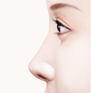 짧은코 및 들창코 성형 시술 전 코끝이 들려 있는 여성의 코 옆모습