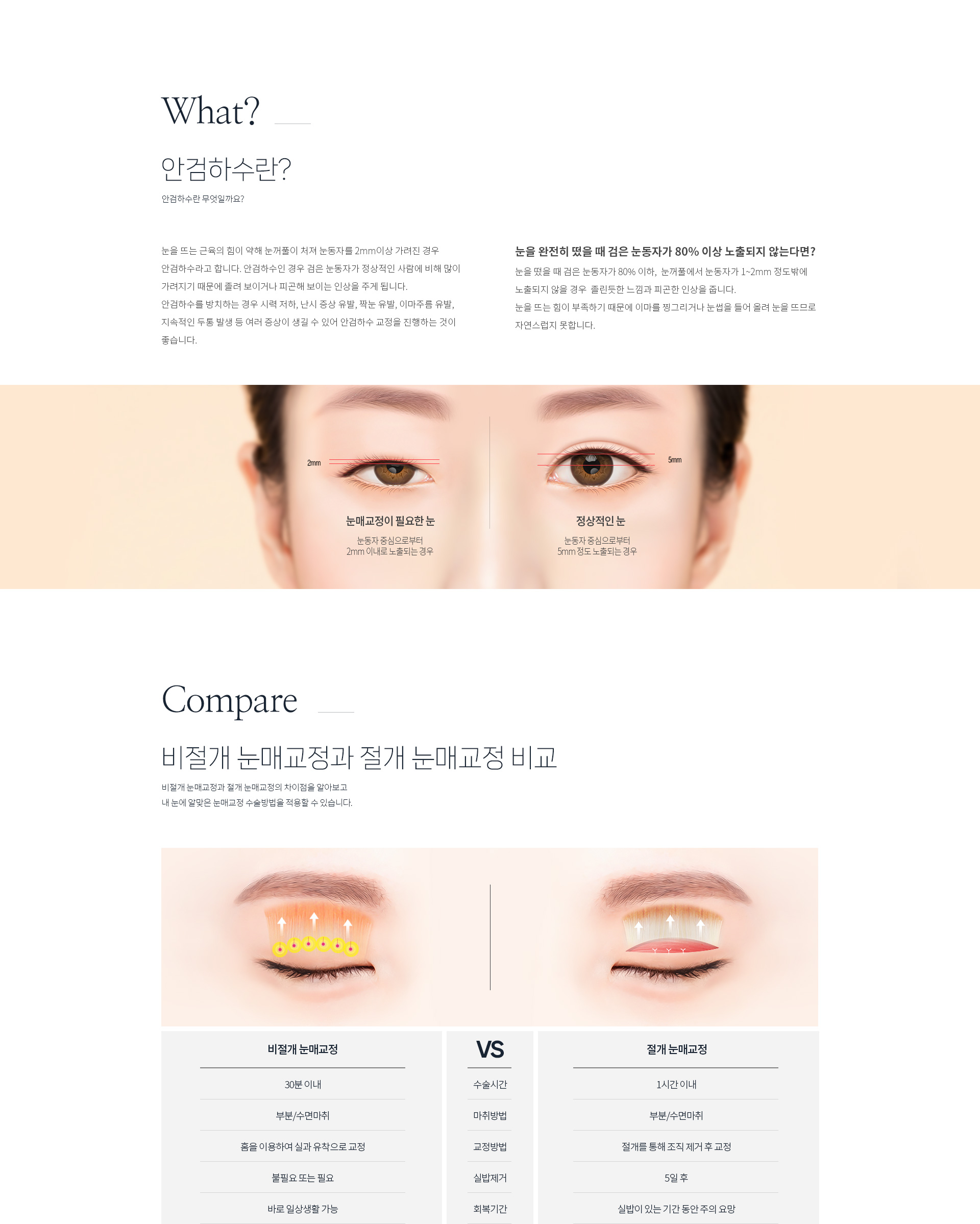 안검하수